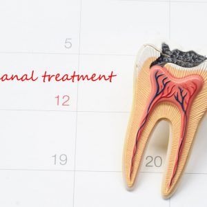 Root Canal Treatment for Children