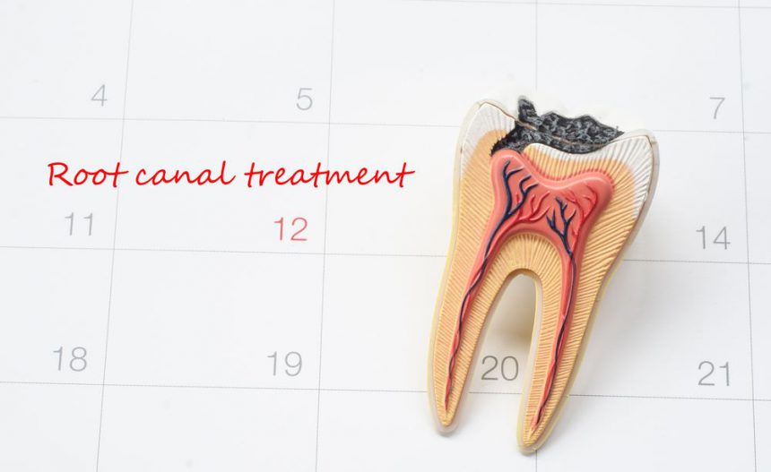 Root Canal Treatment for Children