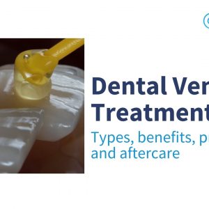 image showing dental veneers application - dental veneers treatment in chembur