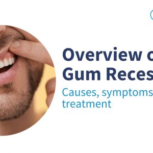 image showing dental gums problems and probably bleeding - gums recession treatment in chembur