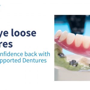 Get your confidence back with Implant-Supported Dentures Chembur