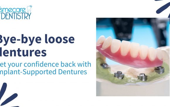Get your confidence back with Implant-Supported Dentures Chembur