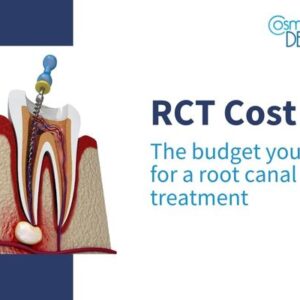 Root Canal Treatment Cost in Chembur