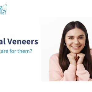 How to care for dental veneers