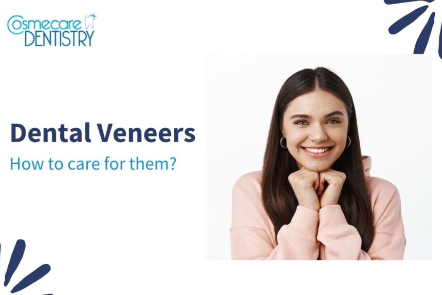 How to care for dental veneers