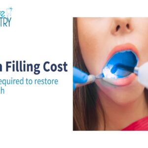 Tooth filling cost in Chembur