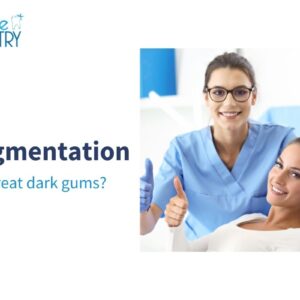 How To Treat Black Gums