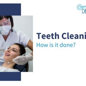 Professional Teeth Cleaning
