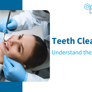 Understanding the Teeth Cleaning Process: Expert Guide