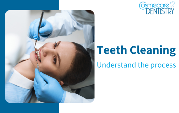 Understanding the Teeth Cleaning Process: Expert Guide
