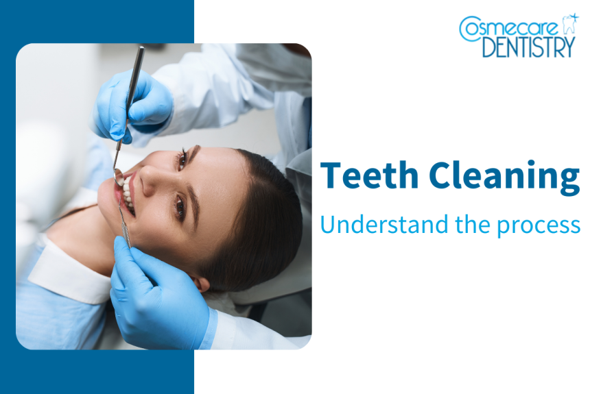 Understanding the Teeth Cleaning Process: Expert Guide